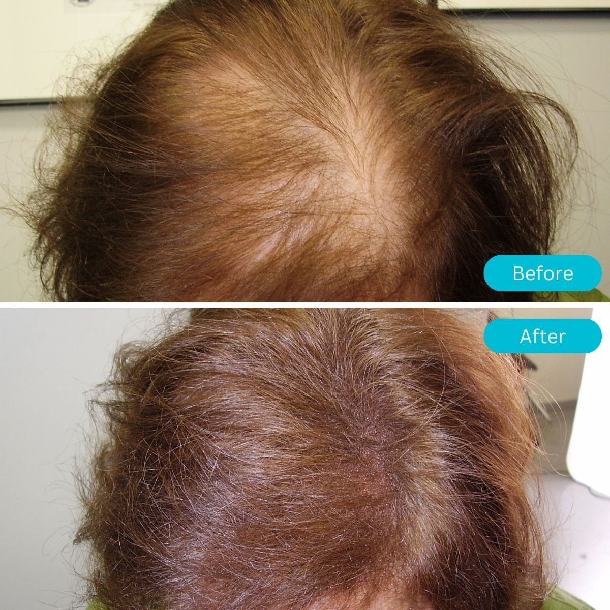 Cabello Pro Rubio Oscuro