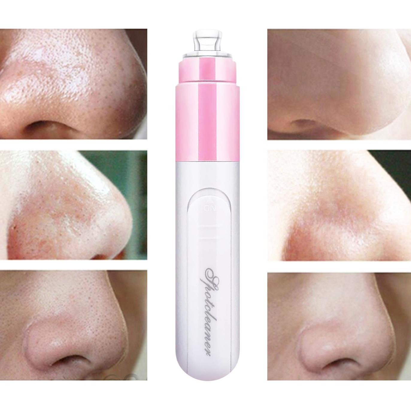 Electric Blackhead Remover - Pink